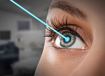 lasik Surgery